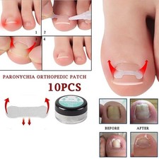 10Pcs Ingrown Toe Nail Correction Sticker Patch Paronychia Corrector Treatment