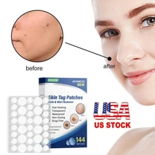 144PCS Skin Tag Remover Patches Hydrocolloid Acne Pimple Remover Wart New USA