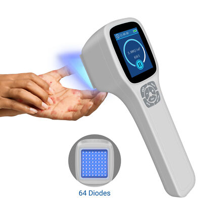 Precision 308nm Targeted Phototherapy Narrowband UVB Lamp For Skin Diseases