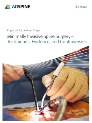 Minimally Invasive Spine Surgery - Techniques, Evidence, And Controversies-image