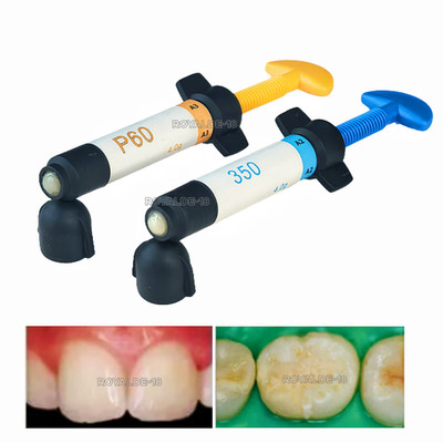 Dental P60 A3/350 A2 Light-Cured Composite Resin Single Bond Universal Adhesive