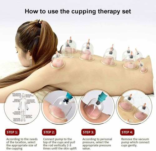 12 Cups set Medical Chinese Vacuum Cupping Body Massage Therapy Healthy Suction - Picture 5 of 12