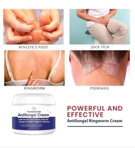 Pharmbanner Antifungal Cream Jock Itch Psoriasis Ringworm Treatment 60g 07/2026 - Picture 6 of 7