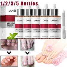LANBENA Fungal Nail Repair Essence Serum Care Finger Toe Anti Nail Repair Liquid