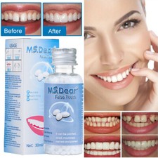 Tooth Repair Kit-Temporary Teeth Replacement Kit for Missing  Broken Teeth 30ML