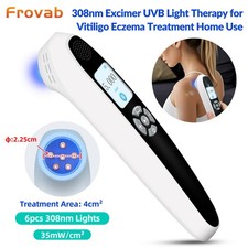 308nm UVB Ultraviolet Light Therapy Device 6 Diodes Handheld for Skin Disorders