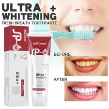 SP-6 Probiotic Toothpaste,Sp-6 Toothpaste Ultra Whitening Quick White Toothpaste