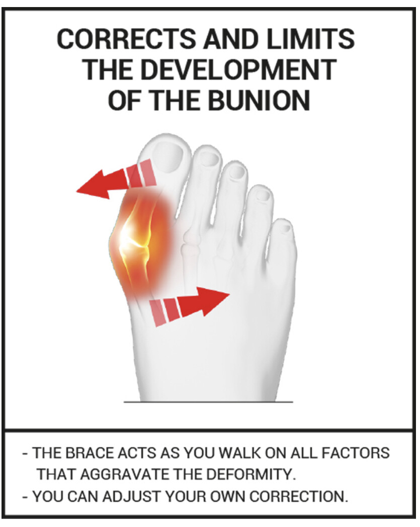 EPITACT Flexible Daytime Bunion Corrector Hallux Valgus Bunion Choose
