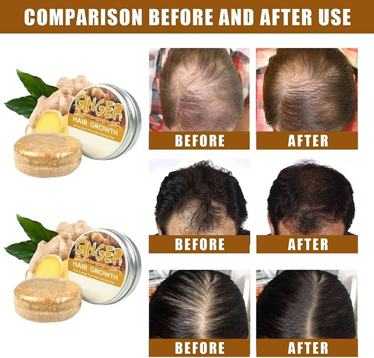 ginger melanotan before and after Mt2 on A How I as a redhead
