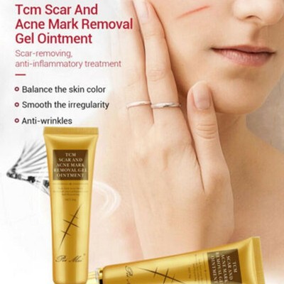 30g Acne Scar Removal Cream Pimples Stretch Marks Face Gel Remove D6Q3 G7J9