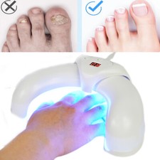 Nail Fungus Laser Treatment Device Beriberi Fungus Killer For Multiple Toenails