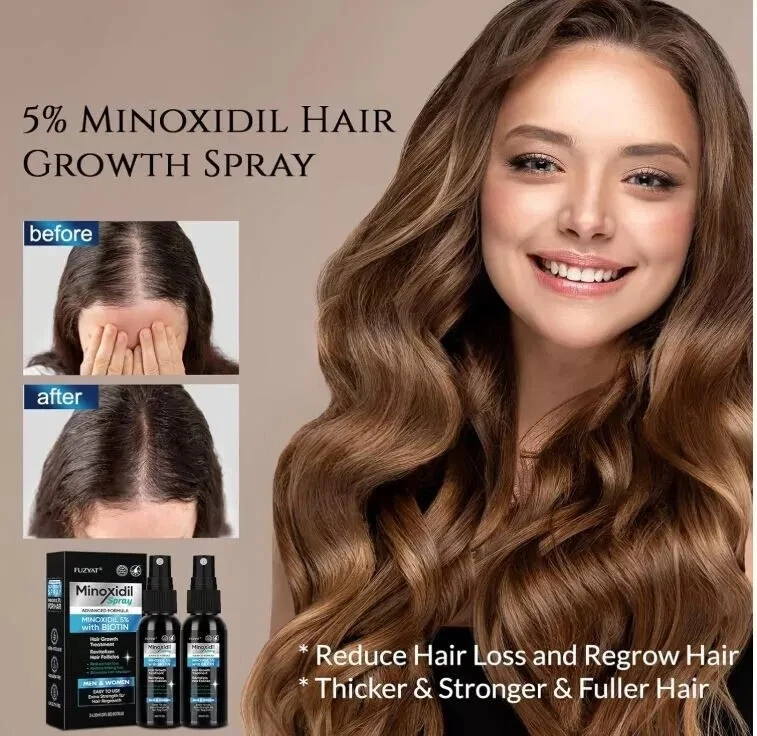 5% Minoxidil Hair Growth Spray for Men & Women - 2PCS Hair Regrowth Solution - Image 2 of 4