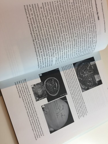 Textbook of Cortical Brain Stimulation Sciences - Picture 8 of 9