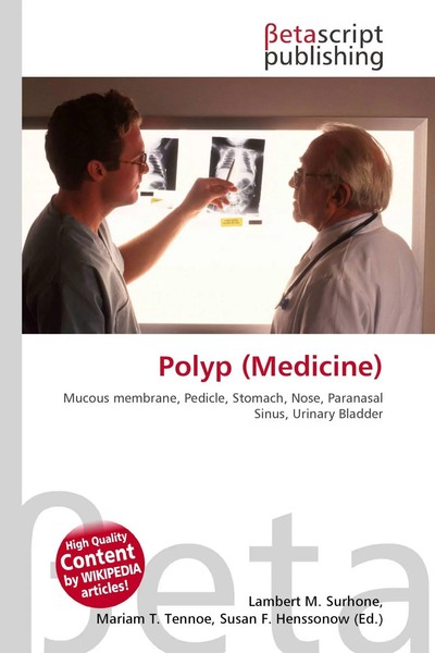 Lambert M. Surhone (U. A.) | Polyp (Medicine) | Taschenbuch | Englisch (2026)-image