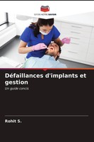 Rohit S. | DéFaillances D'implants Et Gestion | Taschenbuch | FranzöSisch (2021)