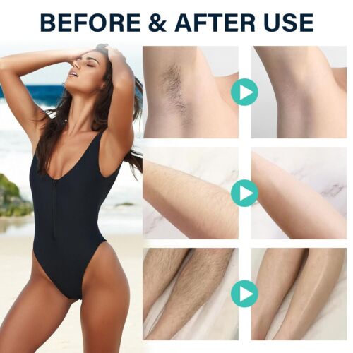 Facial Hair Removal Cream for Men and Women - Depilatory Solution - Picture 5 of 11