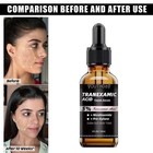 5% Dark Spot Correcting Glow Serum 30ml | Brighten & Even Skin Tone