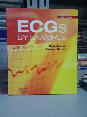 ECGs by Example