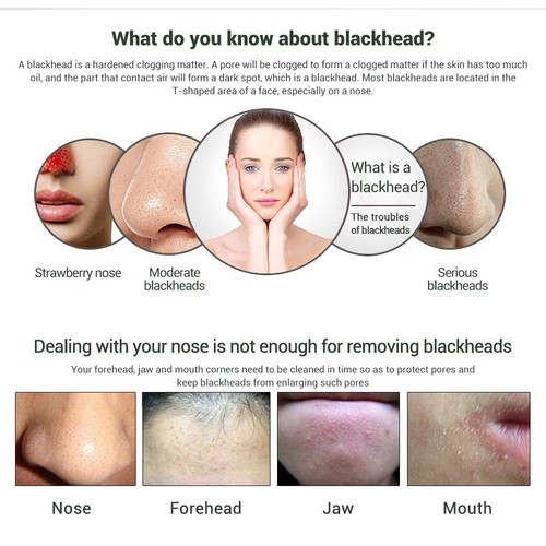 Blackhead Removal Cleaner Mask 50g x 5 units - Picture 4 of 6