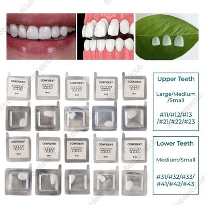 30Size Dental Composite Porcelain Veneers Resin Light Cure Anterior Teeth Veneer