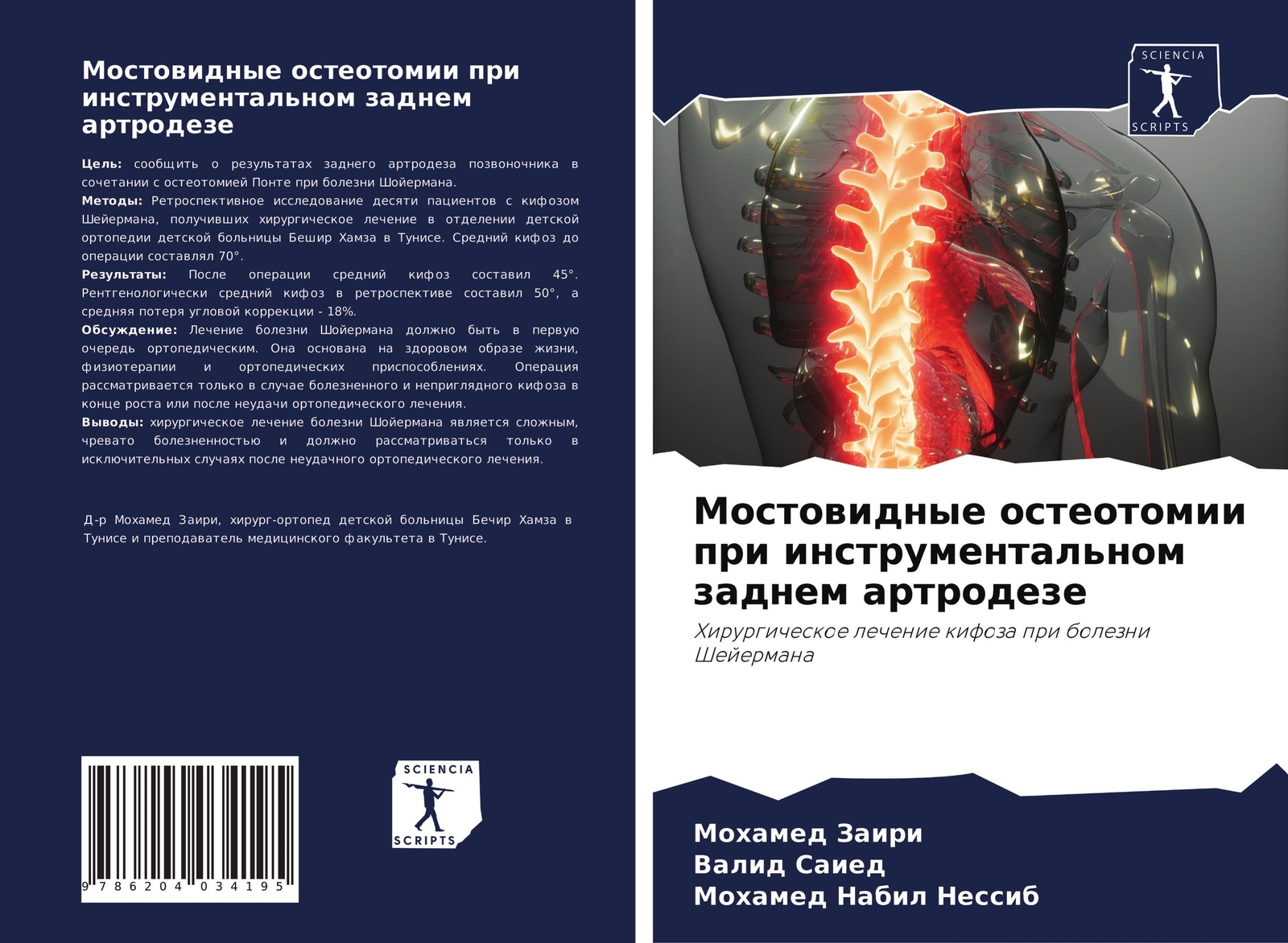Thumbnail - Mostowidnye Osteotomii Pri Instrumental'nom Zadnem Artrodeze Zairi (u.
