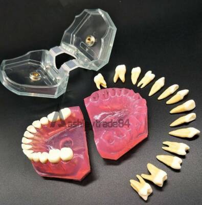 1PCS Dental Teeth Model Study Teach   Model with Removable Teeth New #D9