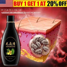 2025 Scalp Hair Follicle Shampoo Antibacterial Anti-Itching Mites Oil Control US