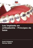 Les Implants En Orthodontie - Principes De Base Sneh Kalgotra (U. A.) Buch 2024