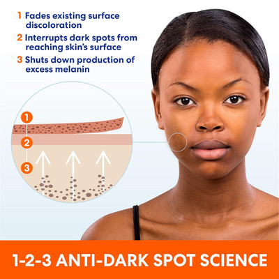 Skin Success Anti-Dark Spot Fade Cream with Vitamin E and Niacinamide, for Al...
