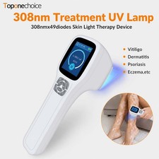 308nm UVB Excimer Phototherapy Device Timer Dose Mode Skin Care Home Use Lamp