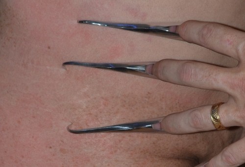 Lot/x Finger Nail Claw/Talon sharp/pointy/pokey sensation violetwand violet wand - Picture 3 of 9
