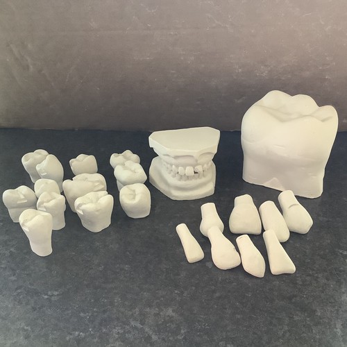 Various Dental Plaster Cast Moulds Human Teeth Mouth Medical Anatomical