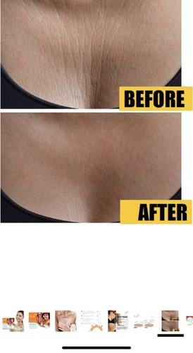 Hoosh Silicone Chest Wrinkle Pads 3 pack Overnight Anti Aging Wrinkle Smoothing - Picture 7 of 8