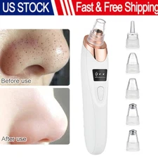 Electric Blackhead Remover Vacuum Facial Pore Cleanser Acne Skin Face Cleanser
