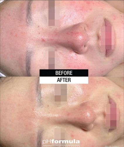 SOS hydra gel mask 50 ml Soothing moisturizing gel mask from Ph-Formula❗❕ - Picture 4 of 4