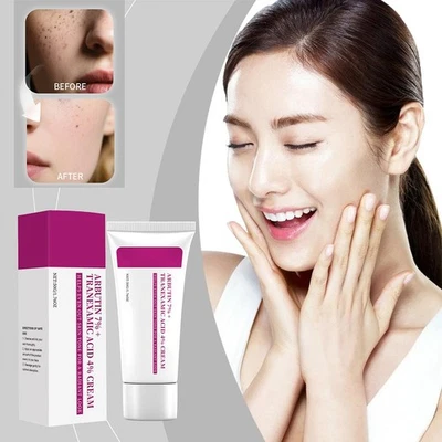 Arbutin 7% Tranexamic Acid 4% Cream 50g Brightening Beauty Skin Moisturize|DE✅ - Bild 1 von 4