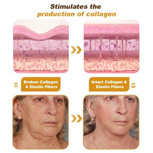 3 Pcs Bee Venom Wrinkle Cream, Bee Venom Anti-Wrinkle Firming Cream, Bee Venom M - Picture 8 of 16