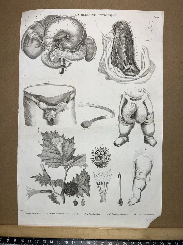 Antiquarische Radierung 1834 Anatomie Medizine Chirurgie Arzt Doktor Botanik - Bild 1 von 4