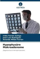 HypophysäRe Makroadenome | Diagnose Durch Kernspinresonanz. | ZúñIga (U. A.)