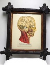 Antique Anatomical/ Medical  Drawing of brain / head / Caved Tramp Art Frame