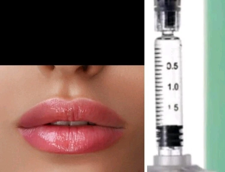 Hyaluronic*Acid/1ml/Hyaluronic Acid/*Acido Hyaluronic/Filler*/Face/Face/Lip