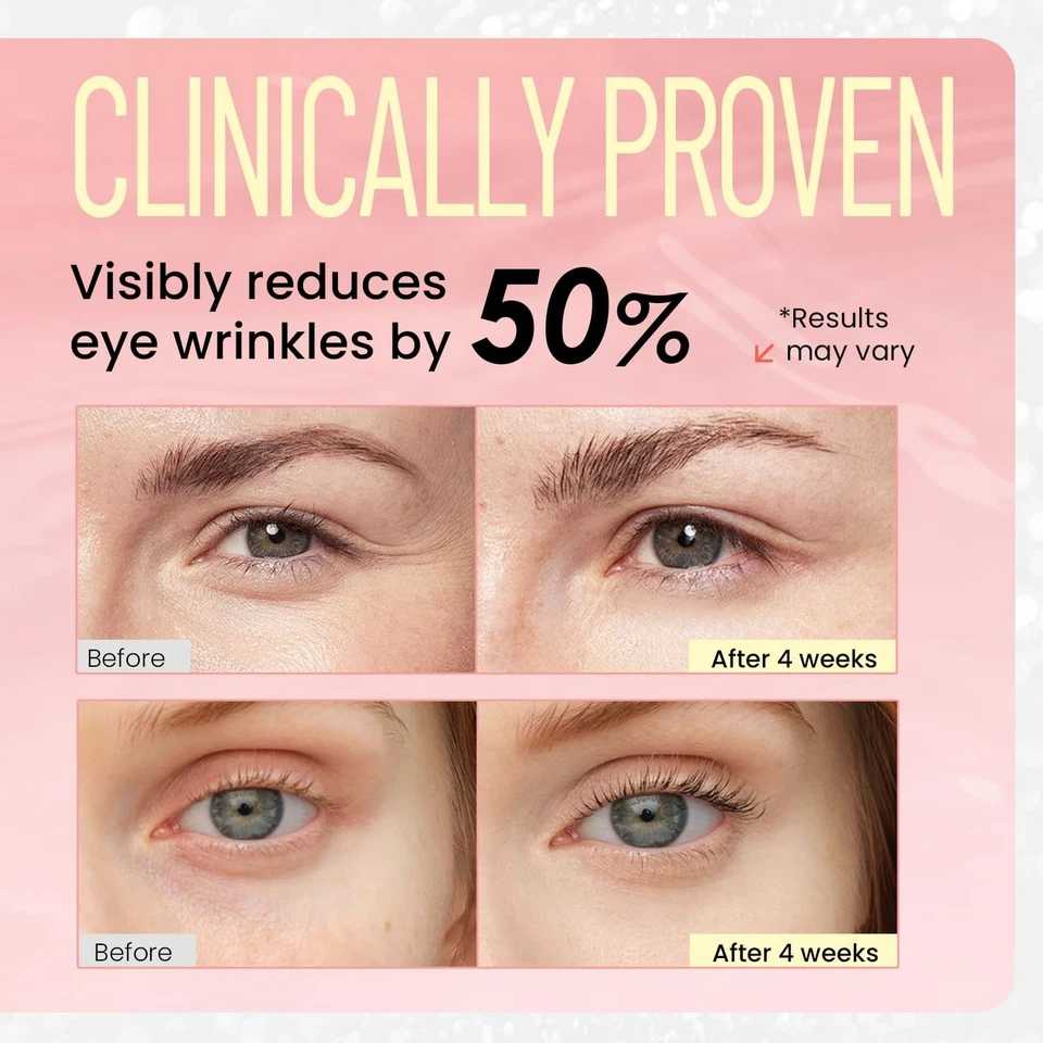 Retinol Eye Repair Cream – Anti‑Aging Serum for Wrinkle & Puffiness Reduction - Image 3 of 4