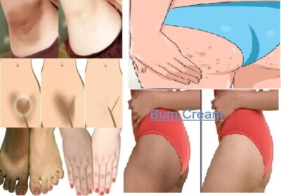 Dark Skin Bum Cream Bleaching Cream Whitening Lightening AHA - 50gm