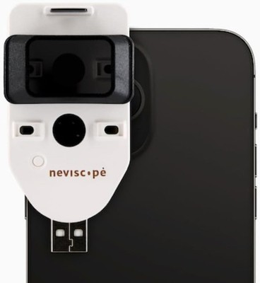 Neviscope Black Phone Dermatoscope Microscope with Polarized Lens/LED Light