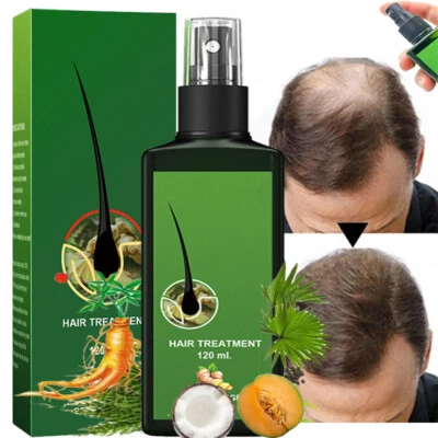 120ML Fast Hair Growth Dense Regrowth Ginger Serum Oil Anti-Loss Treatment Spray
