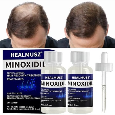 2 Pack Minoxidil 5% Extra Strength Men Hair Regrowth Treatment 2 Month Supply
