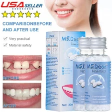 2X Temporary Tooth Repair Kit Teeth&Gaps False Teeth Solid Glue Denture Adhesive