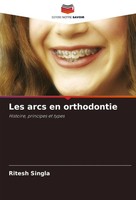 Ritesh Singla | Les Arcs En Orthodontie | Taschenbuch | FranzöSisch (2025)
