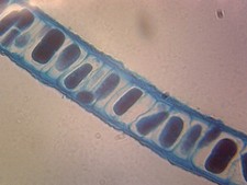 Porphyra; Section of Tallus