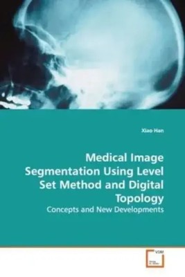 Xiao Han | Medical Image Segmentation Using Level Set Method and Digital...